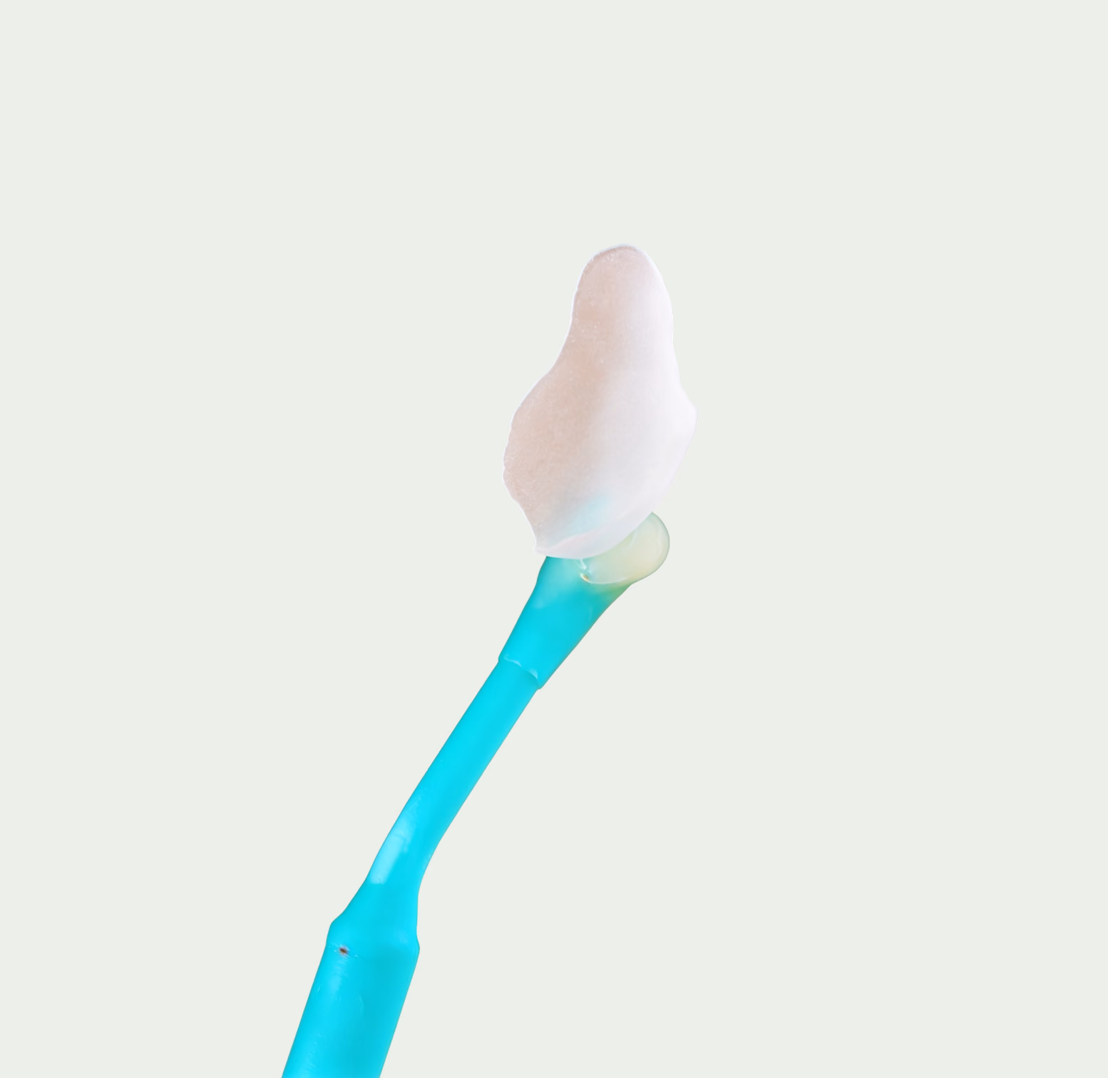 No Prep Veneers — Treatment