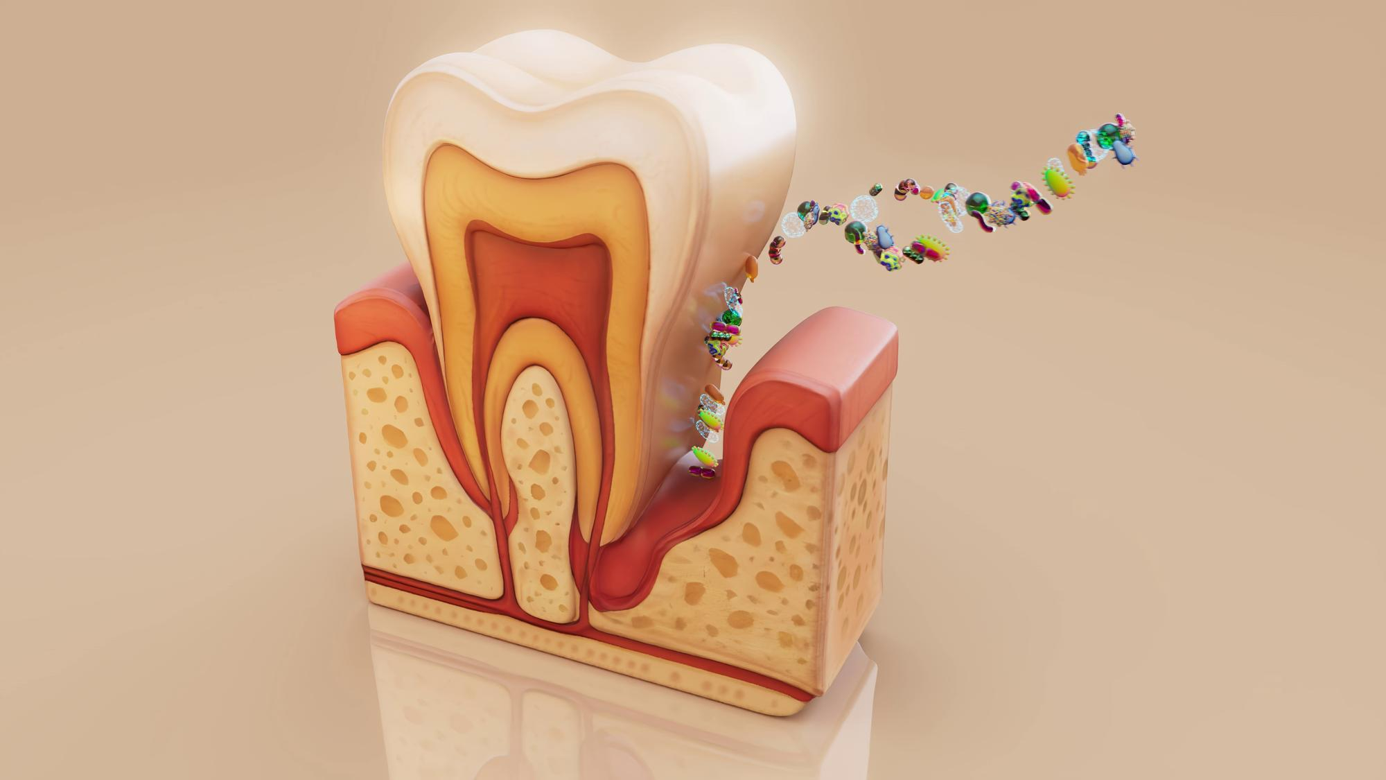 Gum Disease Treatment — Treatment