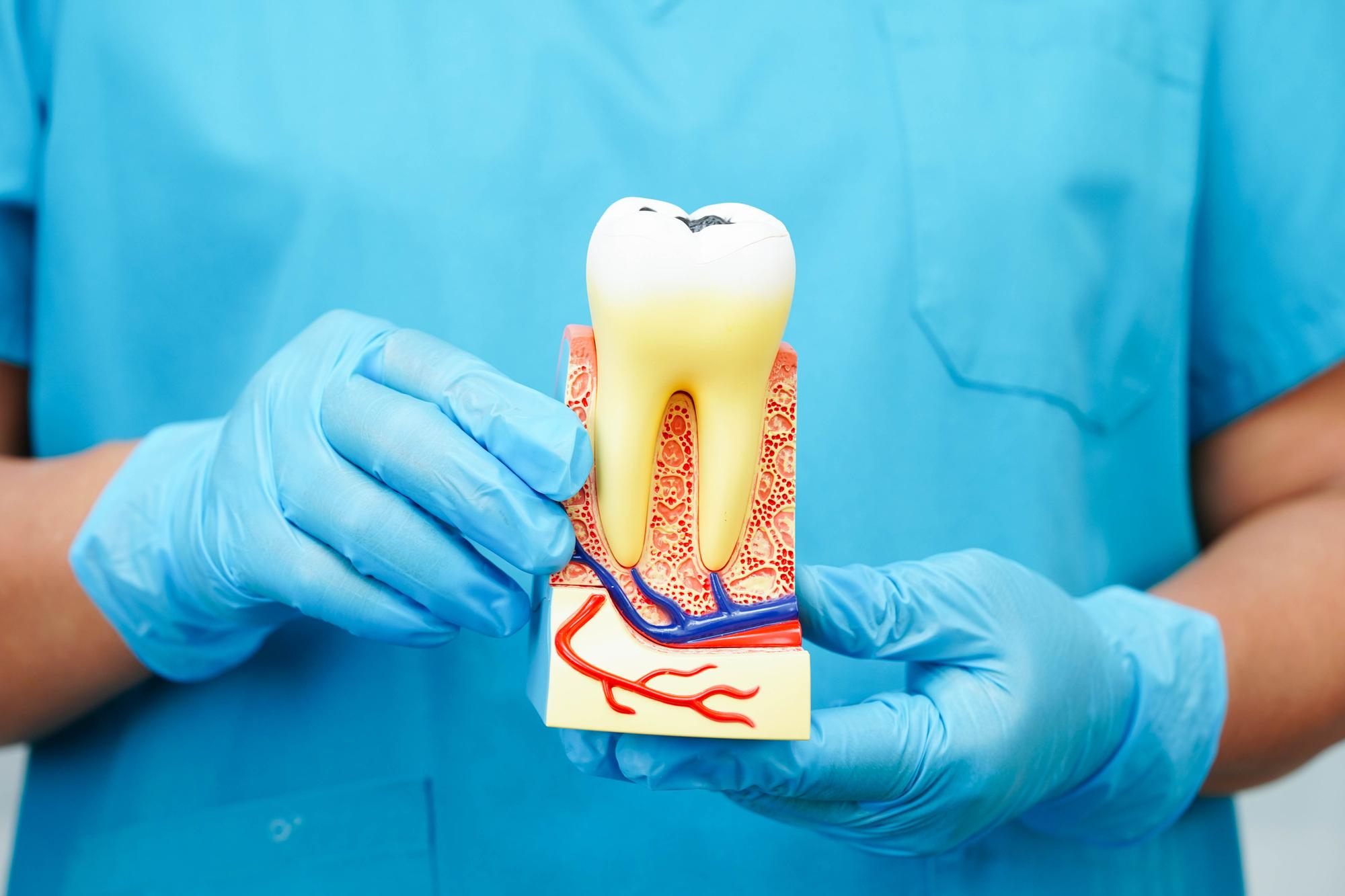 Root Canal Treatment — Treatment