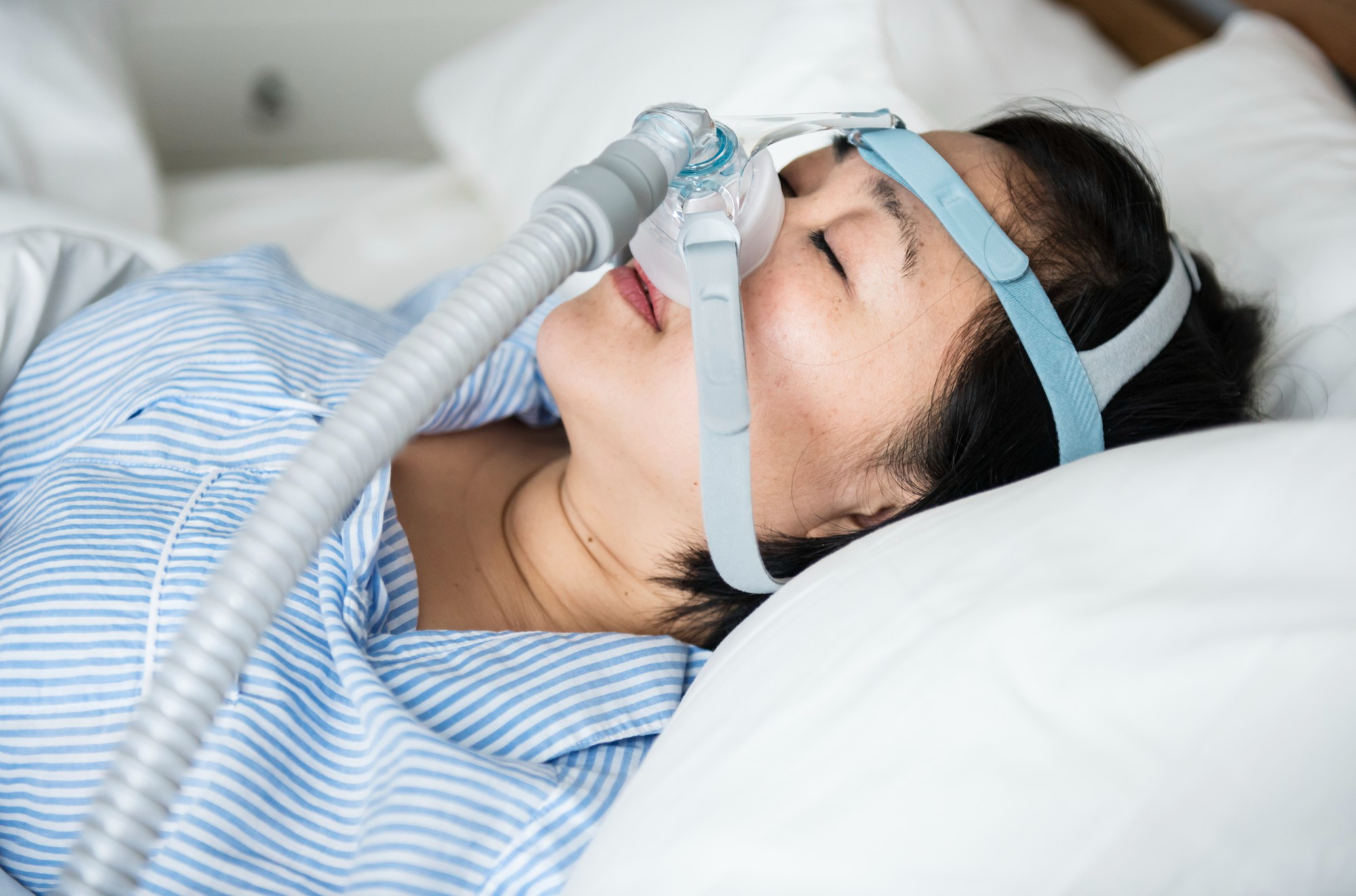 Sleep Apnea Treatment — Treatment